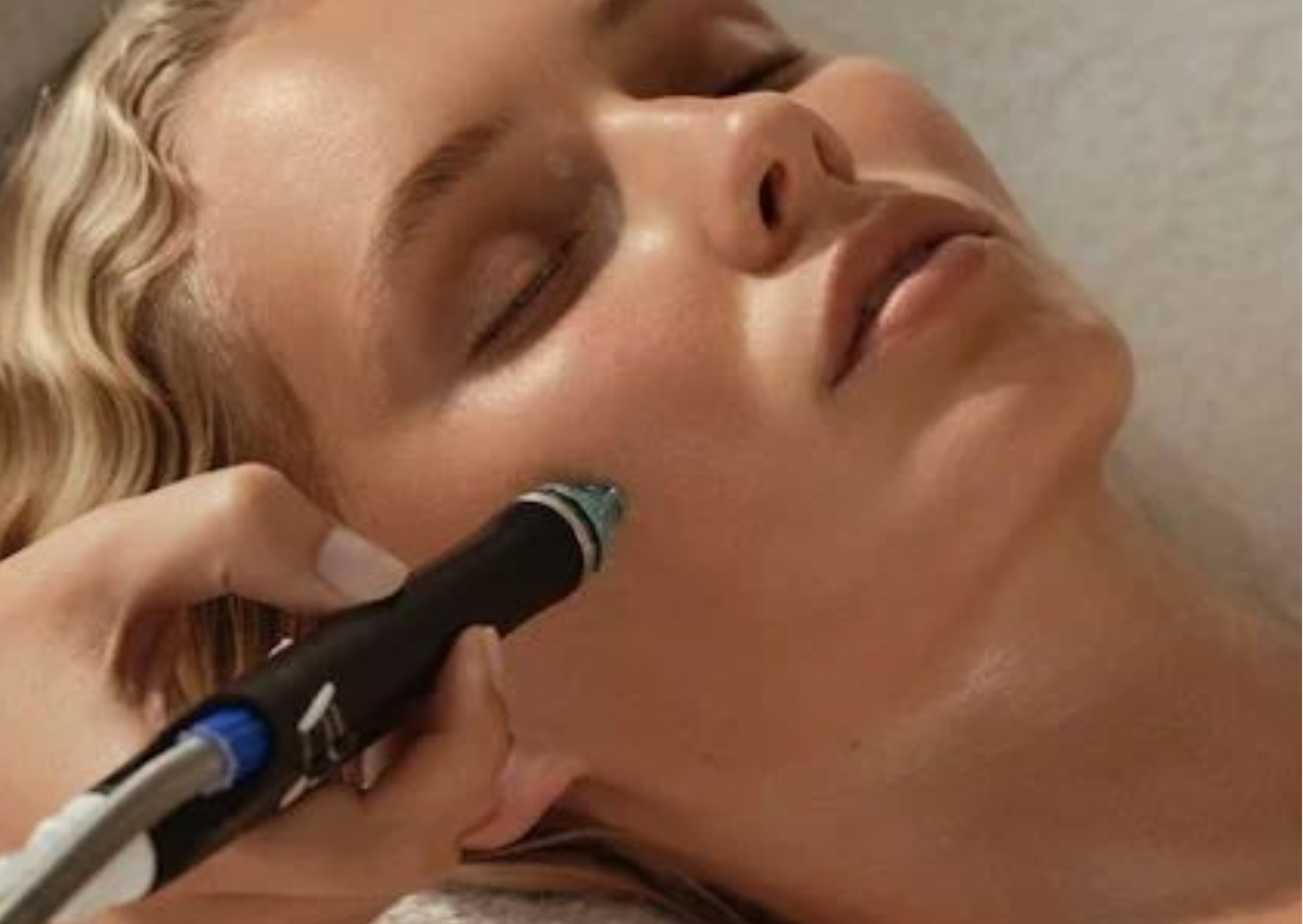 tratamientos faciales acunatura mujer en cabina